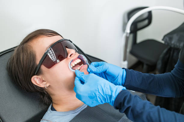 Best Knocked-Out Tooth (Avulsed Tooth) Treatment in Erath, LA